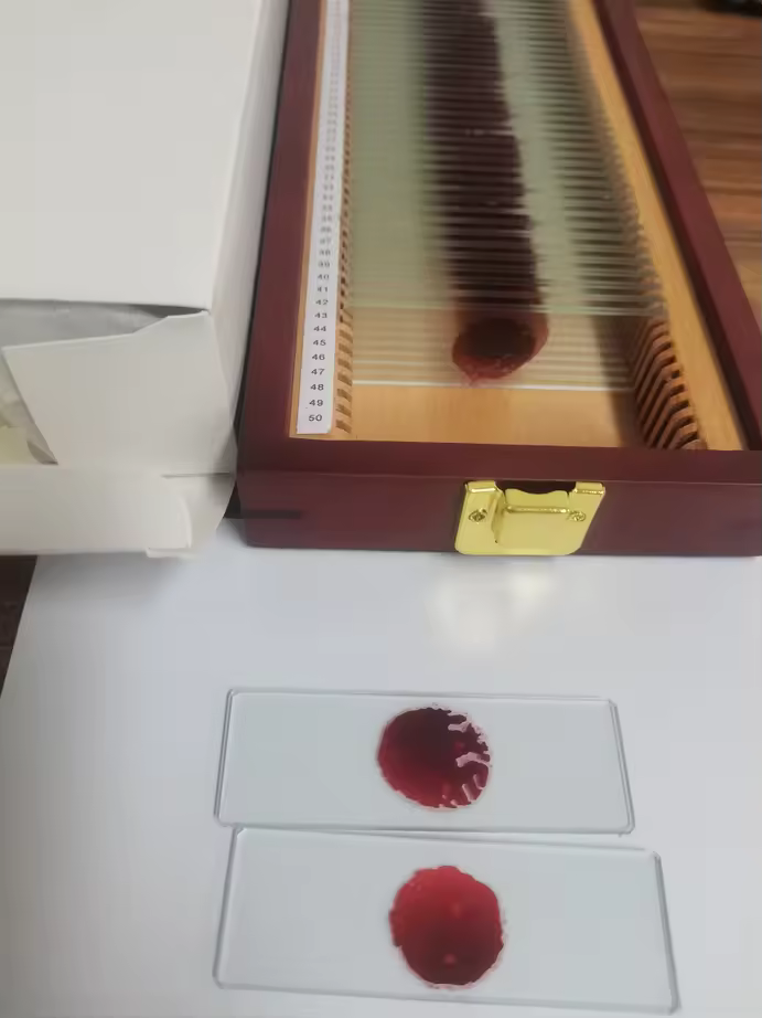 Handcrafted Trophy Case & 46 Blood Stained Slides
